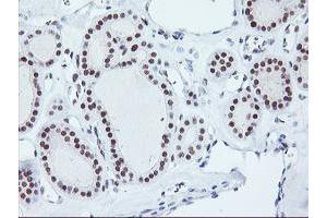 Image no. 5 for anti-Ring Finger Protein 113B (RNF113B) antibody (ABIN1500718) (RNF113B anticorps)