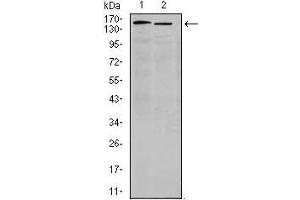 Western blot analysis using ITGA4 mouse mAb against K562(1) and Jurkat (2) cell lysate.