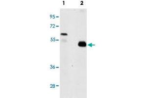 Western blot analysis of TRAF2 (arrow) using rabbit TRAF2 polyclonal antibody . (TRAF2 anticorps  (C-Term))