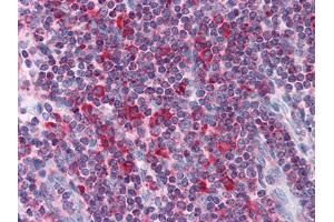 Immunohistochemical analysis of paraffin-embedded human Liver tissues using Metadherin mouse mAb (MTDH anticorps)