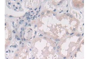 DAB staining on IHC-P; Samples: Human Kidney Tissue (IL-25 anticorps  (AA 28-177))
