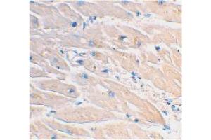 Immunohistochemical staining of human heart tissue using MYD88 polyclonal antibody  at 2 ug/mL . (MYD88 anticorps  (AA 233-248))