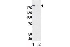 Western blot analysis of phospho-EGFR antibody and HeLa cell lysate, either induced (Lane 1) or noninduced with EGF (2).