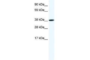 Western Blot showing OBOX6 antibody used at a concentration of 1-2 ug/ml to detect its target protein. (OBOX6 anticorps  (Middle Region))
