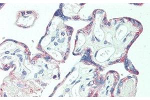 Detection of F5 in Human Placenta Tissue using Polyclonal Antibody to Coagulation Factor V (F5)