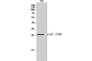 Western Blotting (WB) image for anti-P27 (pThr198) antibody (ABIN3182256)