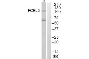 Western blot analysis of extracts from Jurkat cells, using FCRL5 antibody. (FCRL5 anticorps  (Internal Region))