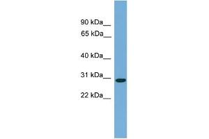 WB Suggested Anti-C20orf201 Antibody Titration: 0. (C20orf201 anticorps  (C-Term))