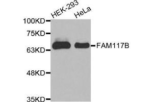 Western Blotting (WB) image for anti-Family with Sequence Similarity 117, Member B (FAM117B) antibody (ABIN1875633) (FAM117B anticorps)