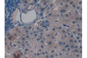 Detection of SNCG in Human Liver Tissue using Polyclonal Antibody to Gamma-synuclein (SNCG)