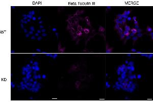 Immunocytochemical staining of Hela cells using Beta Tubulin III antibody (ABIN7800669), 1:1,000), Top panel: wild-type (WT), Bottom panal: Beta Tubulin III shRNA knockdown (KD). (Recombinant TUBB3 anticorps)