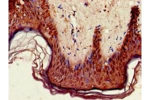 anti-Glycosylphosphatidylinositol Anchored High Density Lipoprotein Binding Protein 1 (GPIHBP1) (AA 21-151) antibody