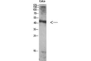 Western Blot (WB) analysis of Colo using Antibody diluted at 1:1000. (ATG4A anticorps  (Internal Region))