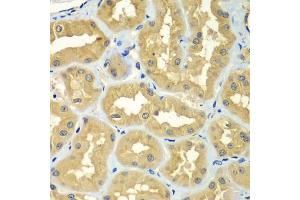 Immunohistochemistry of paraffin-embedded human kidney using GOPC antibody (ABIN6292960) at dilution of 1:100 (40x lens). (GOPC anticorps)