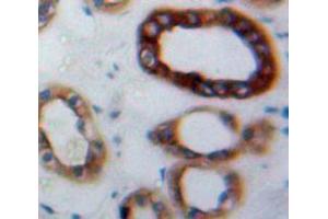 Used in DAB staining on fromalin fixed paraffin-embedded Kidney tissue
