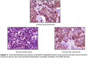 Image no. 1 for anti-B Lymphoid Tyrosine Kinase (BLK) antibody (ABIN232111) (BLK anticorps)