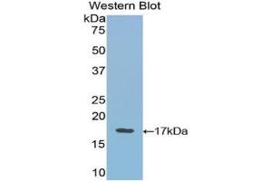 Western blot analysis of the recombinant protein. (VEGFB anticorps  (AA 21-137))