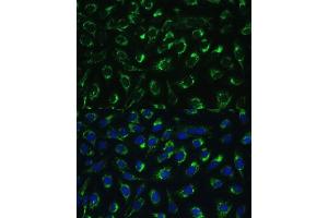 Immunofluorescence analysis of U-2 OS cells using MTIF2 Polyclonal Antibody (ABIN7268591) at dilution of 1:100 (40x lens).