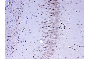 IHC testing of FFPE mouse brain tissue with MED4 antibody at 1ug/ml.