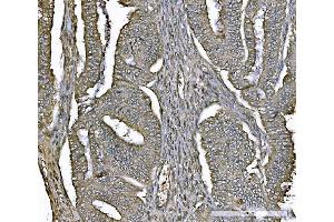 IHC analysis of PARK7/DJ1 using anti-PARK7/DJ1 antibody (ABIN7600468). (PARK7/DJ1 anticorps  (AA 2-189))