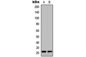 Western blot analysis of DUSP22 expression in HCT116 (A), Raw264.
