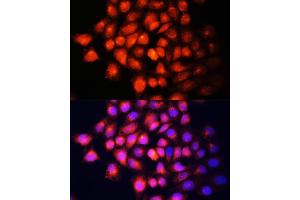 Immunofluorescence analysis of HeLa cells using IGF2 Polyclonal Antibody (ABIN6130483, ABIN6142237, ABIN6142238 and ABIN6218206) at dilution of 1:100 (40x lens). (IGF2 anticorps  (AA 25-180))