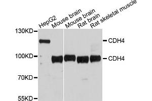 Western blot analysis of extracts of various cell lines, using CDH4 antibody. (Cadherin 4 anticorps)