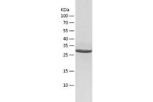 Western Blotting (WB) image for Geranylgeranyl Diphosphate Synthase 1 (GGPS1) (AA 1-300) protein (His-IF2DI Tag) (ABIN7123078)