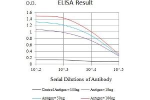 Black line: Control Antigen (100 ng),Purple line: Antigen (10 ng), Blue line: Antigen (50 ng), Red line:Antigen (100 ng)