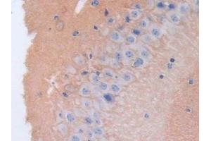 Detection of BCAN in Mouse Cerebrum Tissue using Polyclonal Antibody to Brevican (BCAN)