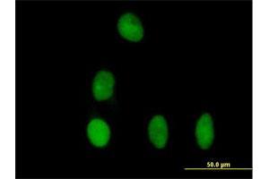Immunofluorescence of purified MaxPab antibody to DBR1 on HeLa cell. (DBR1 anticorps  (AA 1-544))