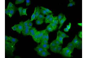 Immunofluorescence staining of HepG2 cells with ABIN7161592 at 1:100, counter-stained with DAPI. (QPRT anticorps  (AA 113-254))
