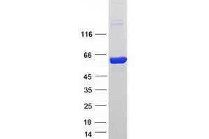 Validation with Western Blot