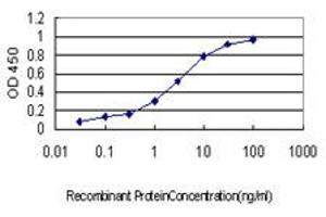 Detection limit for recombinant GST tagged CETN1 is approximately 0.