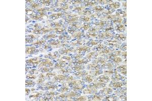 Immunohistochemistry of paraffin-embedded mouse stomach using STXBP2 antibody at dilution of 1:100 (x40 lens). (STXBP2 anticorps)