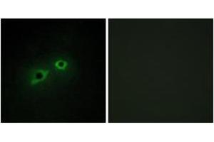 Immunofluorescence analysis of HepG2 cells, using ENTK Antibody. (TMPRSS15 anticorps  (AA 81-130))