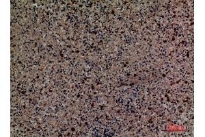 Immunohistochemical analysis of paraffin-embedded human-spleen, antibody was diluted at 1:100. (CD58 anticorps  (Internal Region))