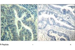 Image no. 3 for anti-Cyclin-Dependent Kinase 6 (CDK6) (pTyr24) antibody (ABIN319290) (CDK6 anticorps  (pTyr24))