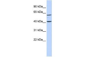 TCTN3 antibody used at 1 ug/ml to detect target protein. (TCTN3 anticorps  (Middle Region))