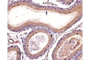 Expression of PAR-4 in rat epididymis - Immunohistochemical staining of rat epididymis paraffin-embedded sections using Anti-PAR4 (F2RL3) (extracellular) Antibody ((ABIN7043077, ABIN7045106 and ABIN7045107), (1:100).