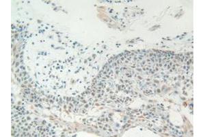Figure. (HMGB1 anticorps  (AA 1-215))
