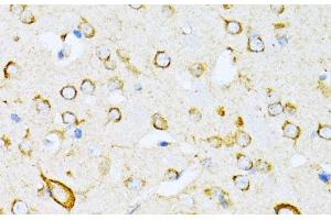 Immunohistochemistry of paraffin-embedded Mouse brain using VARS Polyclonal Antibody at dilution of 1:100 (40x lens). (VARS anticorps)