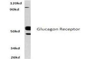Image no. 1 for anti-Glucagon Receptor (GCGR) antibody (ABIN317704) (Glucagon Receptor anticorps)