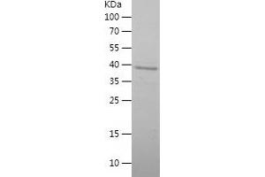 Western Blotting (WB) image for Uncoupling Protein 1 (Mitochondrial, Proton Carrier) (UCP1) (AA 1-183) protein (His-IF2DI Tag) (ABIN7125655)