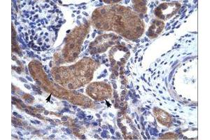 Image no. 1 for anti-IKAROS Family Zinc Finger 2 (IKZF2) (AA 396-445) antibody (ABIN203095)