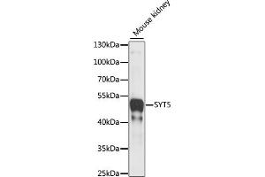 Western blot analysis of extracts of Mouse kidney, using SYT5 antibody (ABIN7270676) at 1:1000 dilution. (Synaptotagmin V anticorps  (AA 1-110))