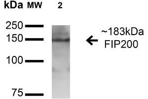 Western blot analysis of Rat Brain cell lysates showing detection of 183 kDa FIP200 protein using Rabbit Anti-FIP200 Polyclonal Antibody .