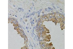 Immunohistochemistry of paraffin-embedded Human prostate using TRPA1 Polyclonal Antibody at dilution of 1:100 (40x lens).