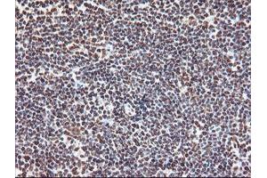 Image no. 6 for anti-Exosome Component 7 (EXOSC7) antibody (ABIN1498140)