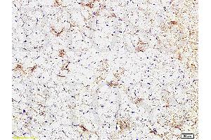 Formalin-fixed and paraffin embedded rat heart tissue labeled Anti-CTGF Polyclonal Antibody, Unconjugated (ABIN672636) at 1:200, followed by conjugation to the secondary antibody and DAB staining